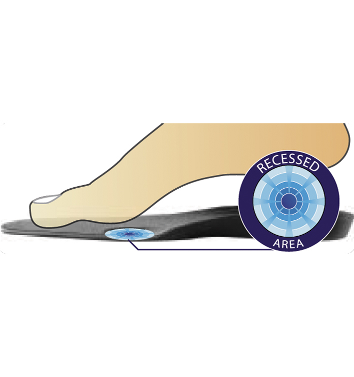 DonJoy Arch Rival - Foot Orthotic